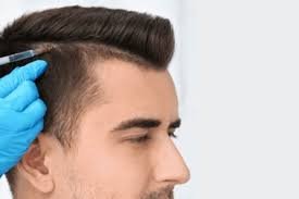 Discover the Best Hair Transplant Options in Dubai: Your Path to Fuller, Healthier Hair